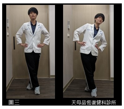 髕骨軟化症 髕骨軟化症