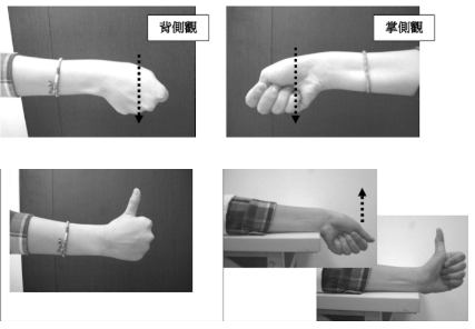 媽媽手網球肘 媽媽手網球肘