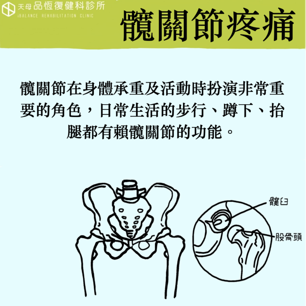 髖關節疼痛 髖關節疼痛