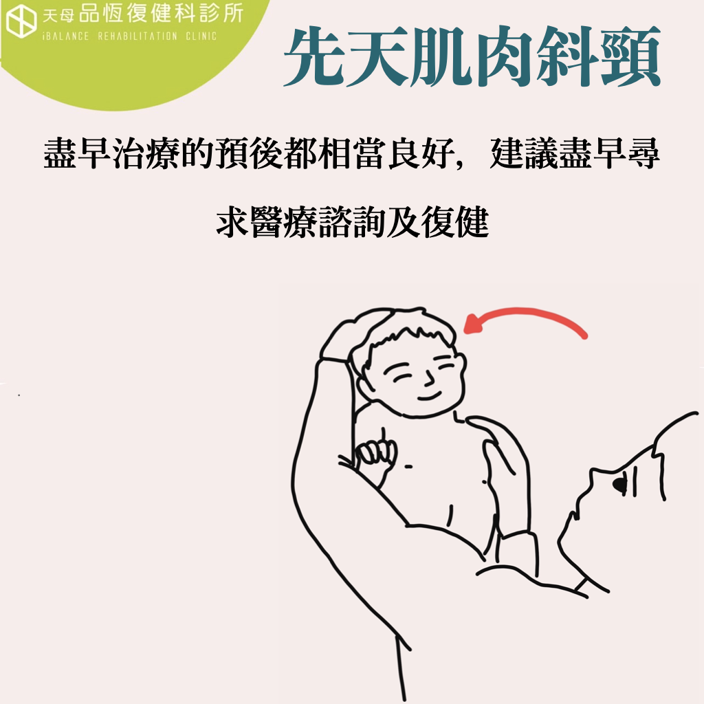 寶寶頭歪一邊 : 先天肌肉斜頸 寶寶頭歪一邊 : 先天肌肉斜頸
