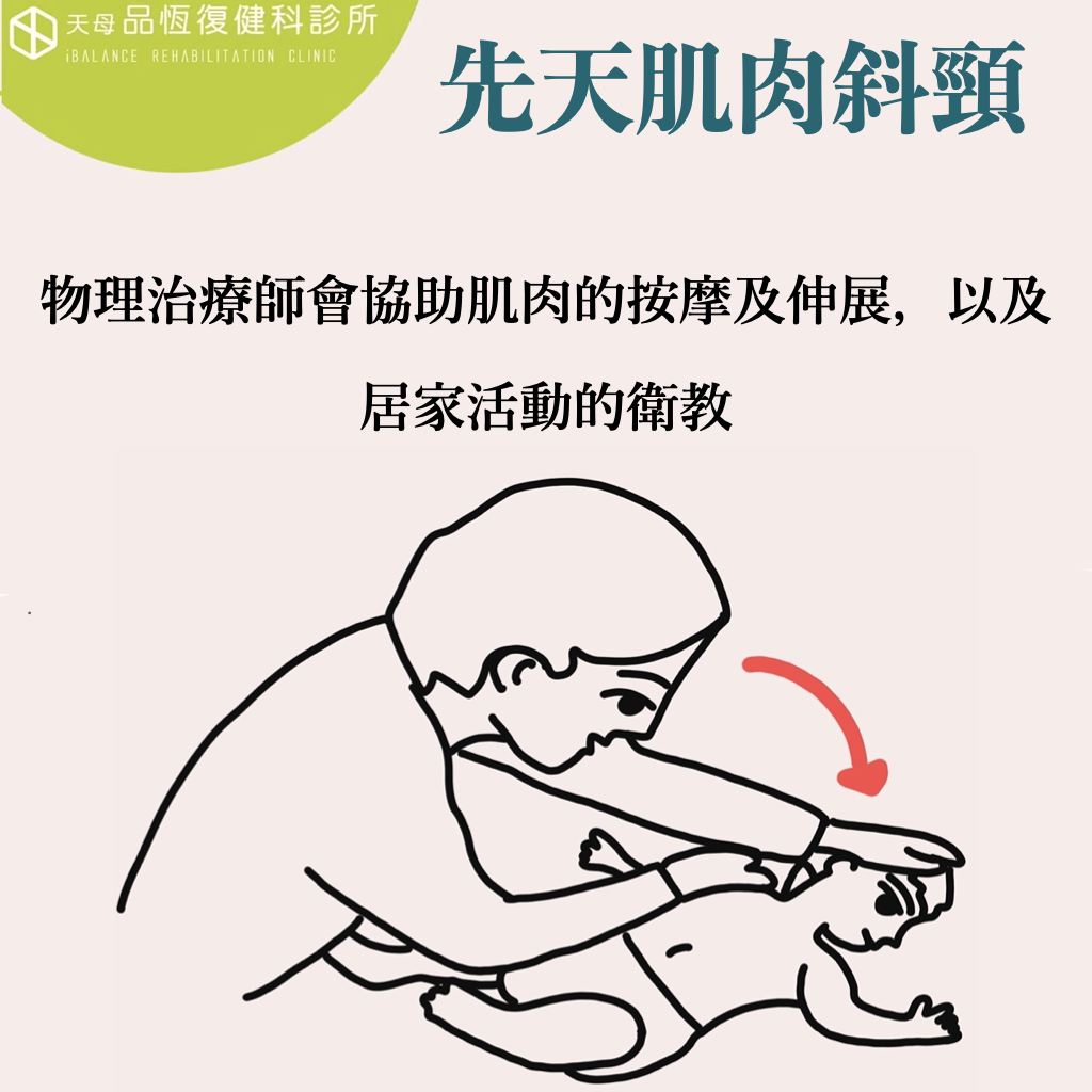 寶寶頭歪一邊 : 先天肌肉斜頸 寶寶頭歪一邊 : 先天肌肉斜頸