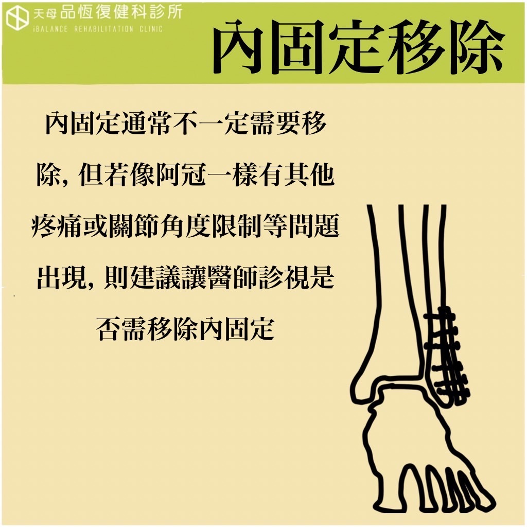骨折內固定器移除之後, 還需要復健嗎? 骨折內固定器移除之後, 還需要復健嗎?