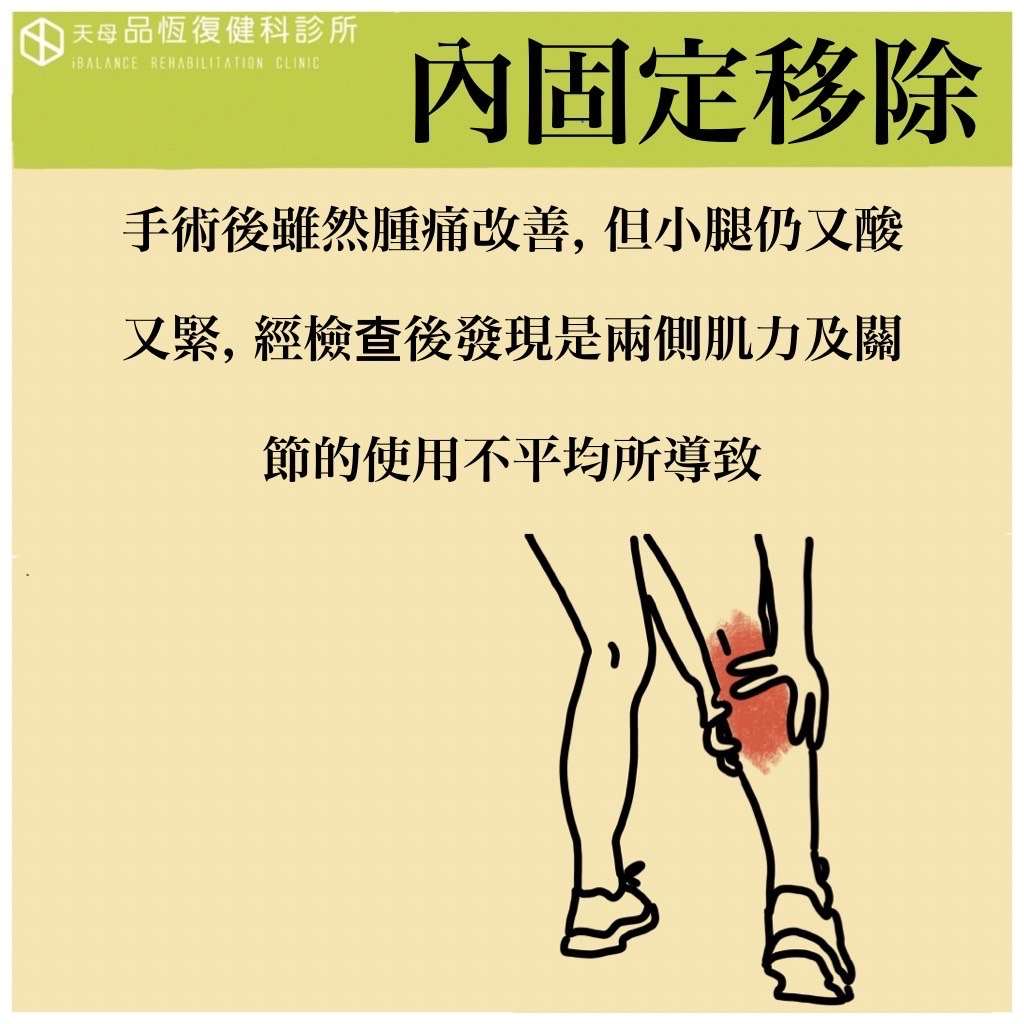 骨折內固定器移除之後, 還需要復健嗎? 骨折內固定器移除之後, 還需要復健嗎?