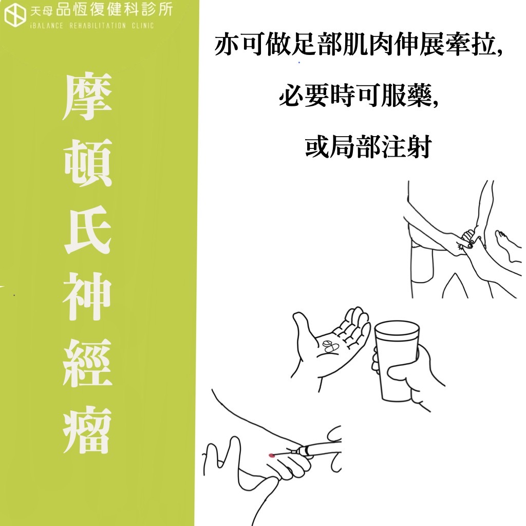 Morton's neuroma 摩頓氏神經瘤 Morton's neuroma 摩頓氏神經瘤