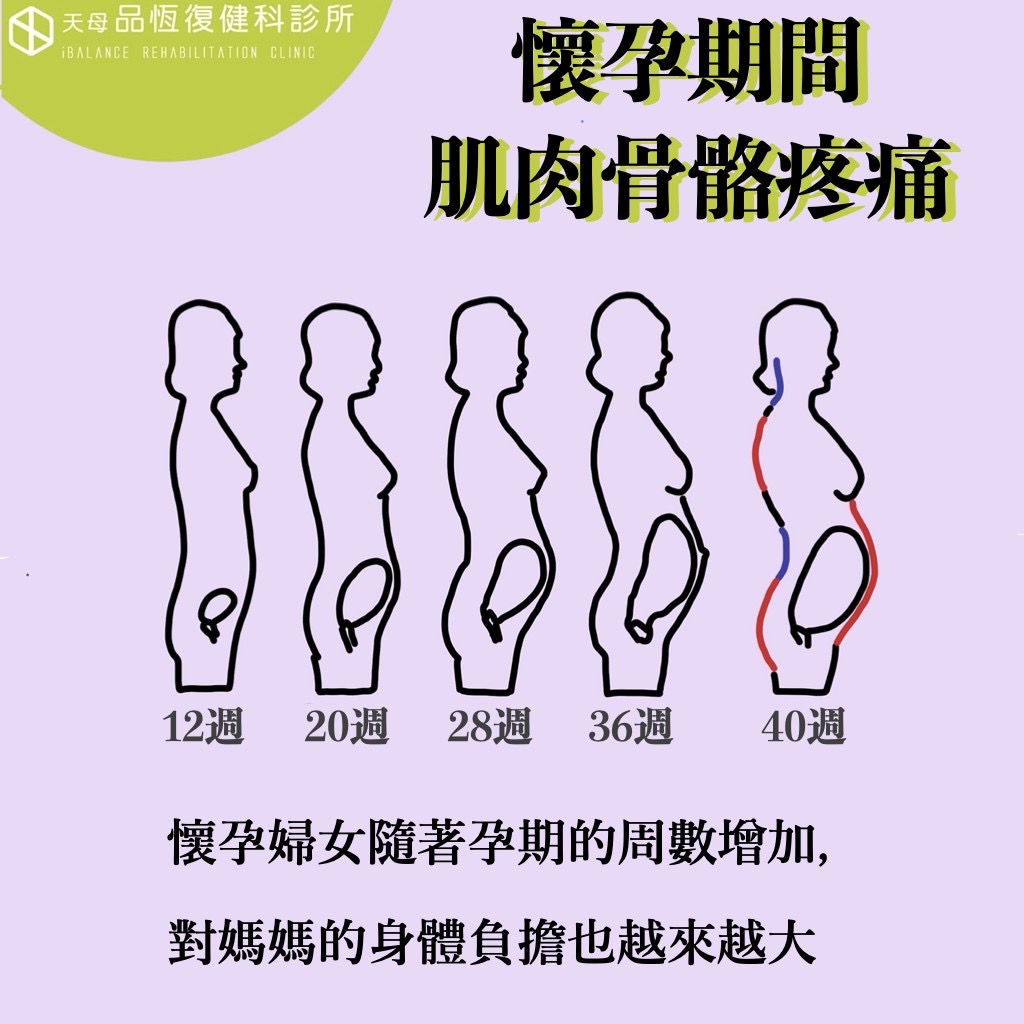 懷孕期間肌肉骨骼疼痛 懷孕期間肌肉骨骼疼痛