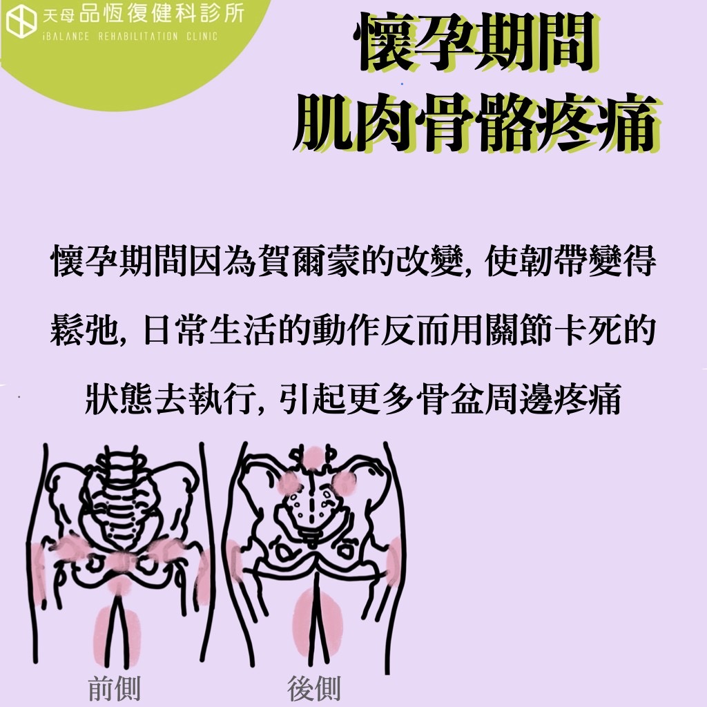 懷孕期間肌肉骨骼疼痛 懷孕期間肌肉骨骼疼痛