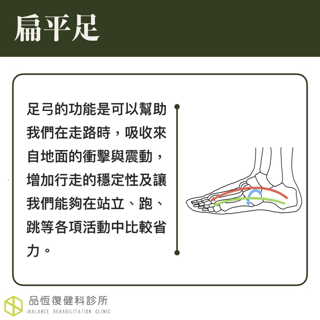 扁平足 扁平足
