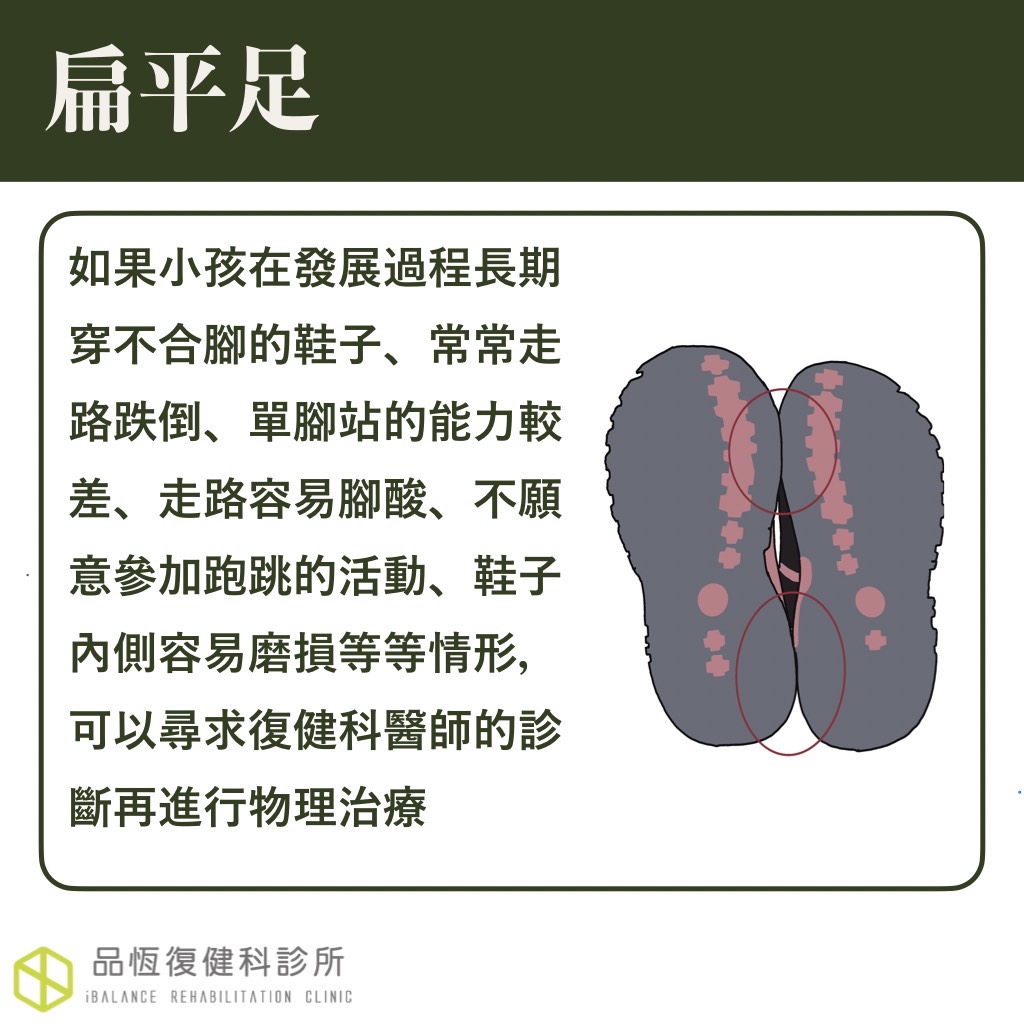 扁平足 扁平足
